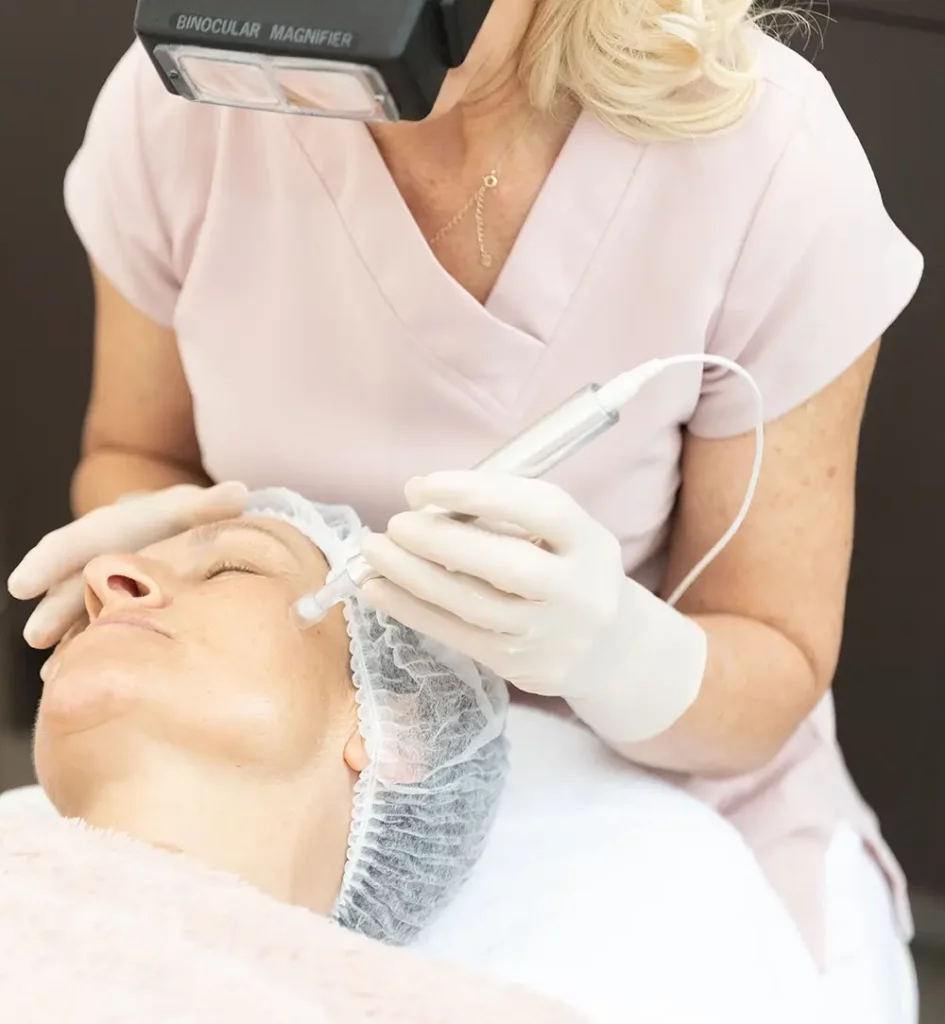 Micro needling Day Spa Mornington
